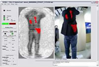 Whole Body Scanners (AIT) - Current Technologies